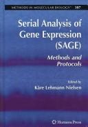 Serial analysis of gene expression (SAGE)