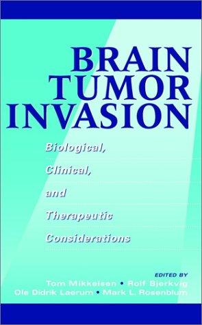 Brain tumor invasion