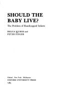 Should the baby live?